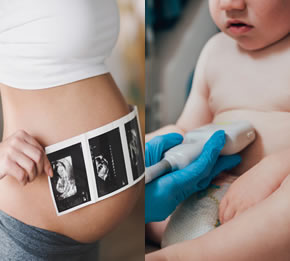 Ecografia Neonatale